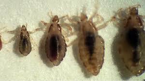 What Do Lice Look Like The Video Is Kinda Gross But Necessary